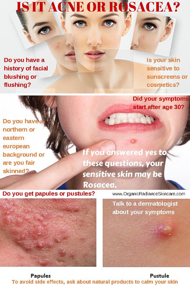 Sensitive Skin: Identifying Symptoms and Causes